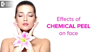 5 Effects of Chemical Peel on face | Effect on Hyper pigmentation, Acne, Aging - Dr. Pallavi Reddy