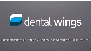 Come Modellare un Ponte a 3 elementi con Ceratura Virtuale DWOS™