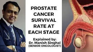 What is the Advanced Prostate Cancer Survival Rate | Explained by Dr. Manish Singhal