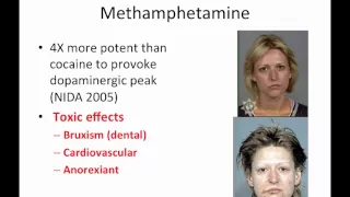 Toxic Effects of Illicit Drug Use by Dr  Sophie Gosselin Keynote Speaker