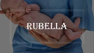 Rubella - clinical features, investigation, treatment