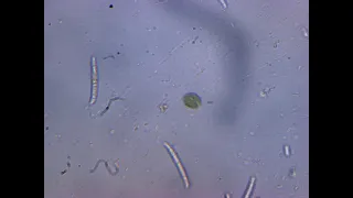 хламидомонада под микроскопом