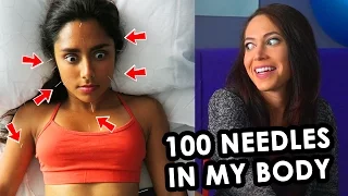 TRYING EXTREME ACUPUNCTURE (100 NEEDLES!!!) with ElloSteph