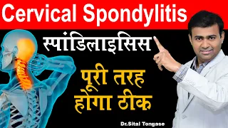 स्पॉन्डिलाइटिस  पूरी तरह होंगा ठीक I Cervical Spondylosis | Cervical Exercise