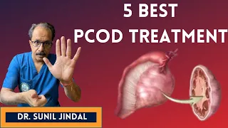 5 Best PCOD Treatment|5 सर्वश्रेष्ठ पीसीओडी उपचार |Dr. Sunil Jindal|Jindal Hospital Meerut