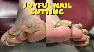 Cutting Thick, Hard To Cut Nails On 88-Year-Old Karaoke Queen!