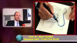 embolizasyon tedavisi 0530 951 51 66 Ameliyatsız Tedavi Prof  Dr  Saim Yılmaz