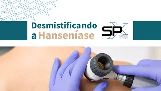 Desmistificando a Hanseníase