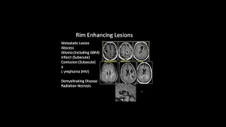 Dr. Velaydun. Intracranial Infections Imaging.