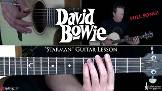 Starman Guitar Lesson - David Bowie