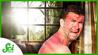 Can You Get a Sunburn Behind a Window?