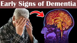 8 Early Signs of Dementia OR Alzheimer's