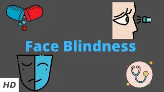 Face Blindness, Causes, Signs and Symptoms, DIagnosis and Treatment.