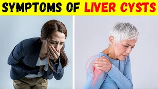 Symptoms of Liver Cysts and Pain  Causes and Treatment