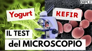 Kefir vs Yogurt: Test al Microscopio.