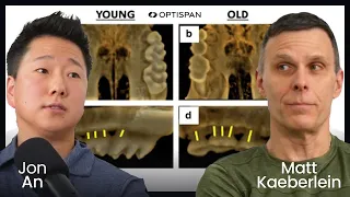 Dentist Reveals Exciting Research Findings Involving Rapamycin on Oral Health | 5 - Jon An, DDS, PhD