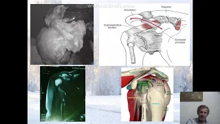 physical therapy treatment  for frozen shoulder 2020