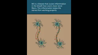 Multiple Sclerosis: My Life with MS | Merck Manuals Hidden Health Stories