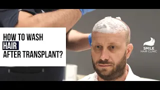 HOW TO WASH YOUR HAIR AFTER HAIR TRANSPLANT? | DR. FIRDAVS AHMEDOV | SMILE HAIR CLINIC