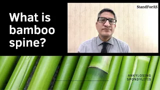 Ankylosing spondylitis: what is bamboo spine? How can one prevent it?