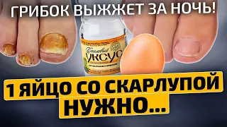 Врач не помог, а мамин рецепт СПАС мои ногти! Грибок ногтей на ногах