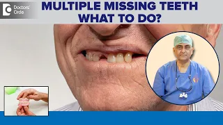 MULTIPLE MISSING TEETH | Know the Tooth Replacement Options-Dr.Manesh Chandra Sharma|Doctors’ Circle