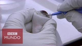 Cómo se extraen y almacenan córneas para transplantar - BBC Mundo