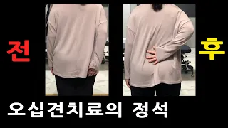 이 영상은 오십견 치료의 교과서가 될 영상입니다/ 어깨통증 도수치료