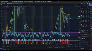 SQQQ |  ProShares UltraPro Short QQQ