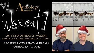 SOFT EAR WAX REMOVAL FROM A NARROW EAR CANAL - EP692