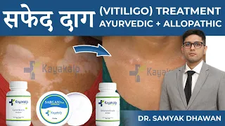 Vitiligo Skin Disease Treatment in Hindi | सफेद दाग का इलाज/उपचार कैसे करे? Kayakalp Global