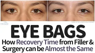 How Recovery for Under Eye Filler and Eye Bag Surgery can be Almost the Same