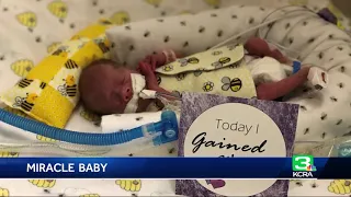 Miracle Premature Baby Goes Home On Due Date