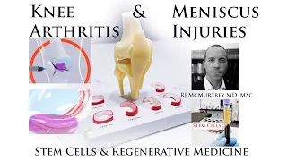 Regenerative Stem Cell Therapy for Knee Arthritis, Cartilage, Meniscus Tears, Joints + Case Examples