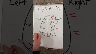 What is dyslexia?