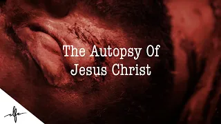 Rebel: Ch 2 "THE AUTOPSY OF JESUS CHRIST"