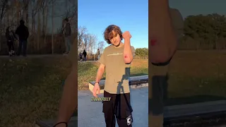 BACKFLIP OVER A SCOOTER KID?!? 😱😱😱