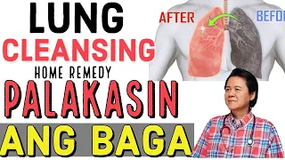 Palakasin ang Baga: For "Cleaner" Lungs - Payo ni Doc Willie Ong #750c