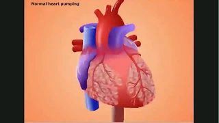 4a  Animation   Cardiac Action Potential   11mins36secs