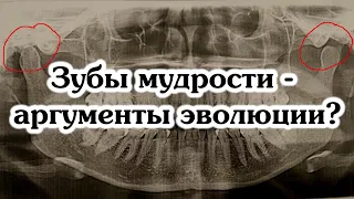 Зубы мудрости, копчик и аппендикс - аргументы эволюции?