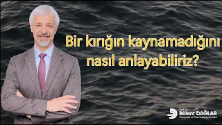 Kırıkların kaynayıp kaynamadığını nasıl anlarız?