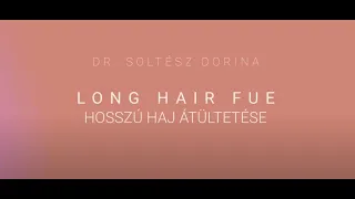 Long Hair FUE - Budapest, Hungary - Hosszú haj átültetése