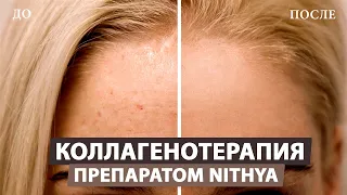 Улучшаем качество кожи лица с помощью коллагена «Nithya» (Нития)