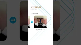 ANYRIDGE® Drilling Sequence ▶️