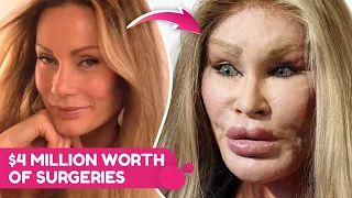 Stars Who Were Never The Same After Plastic Surgeries | Rumour Juice