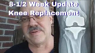 Combined 7 and 8 week update after my total knee replacement surgery