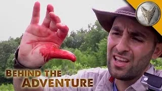 Brave Wilderness | OUCH! Animal Bites!