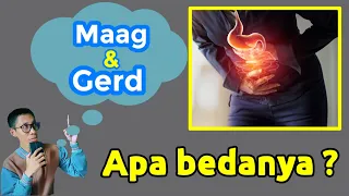 Apa itu Maag & GERD ? Begini perbedaannya