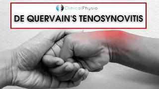 De Quervain's Tenosynovitis | What is it? How do you treat it?