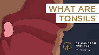 About tonsils and a tonsillectomy